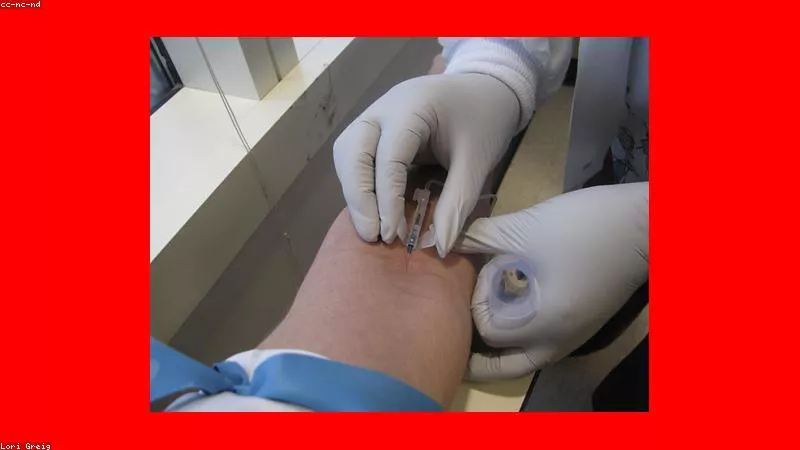 Giải đáp thắc mắc: Uống Sildenafil 100mg hàng ngày có gây lờn thuốc?